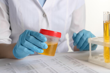 Nurse holding container with urine sample for analysis at table, closeup - obrazy, fototapety, plakaty