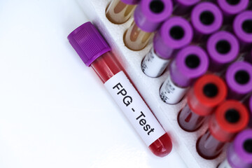 FPG-test from blood , Blood samples to be analyzed in the laboratory