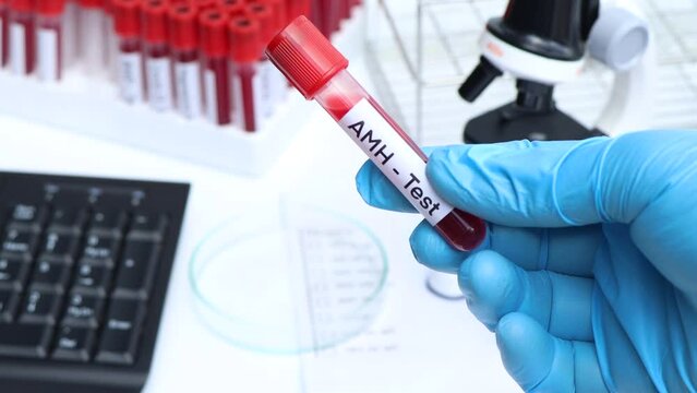AMH test to look for abnormalities from blood,  blood sample to analyze in the laboratory, blood in test tube