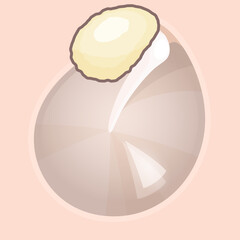 真珠腫性中耳炎の鼓膜のイラスト_上鼓室型真珠腫