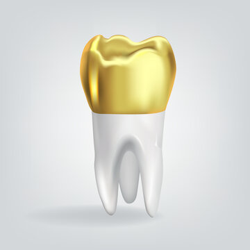 Realistic tooth with golden crown. Vector illustration