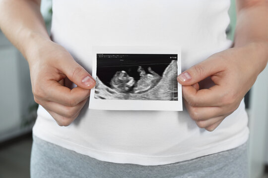 Pregnant woman with ultrasound picture of baby indoors, closeup