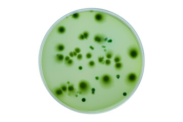 Petri dish or culture media with bacteria on white background with clipping, Test various germs, virus, Coronavirus, COVID-19, Microbial population count, Food science.