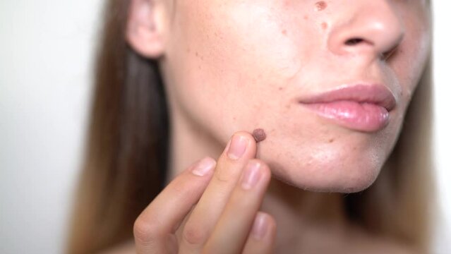 Face Mole. Close up mole on the face
