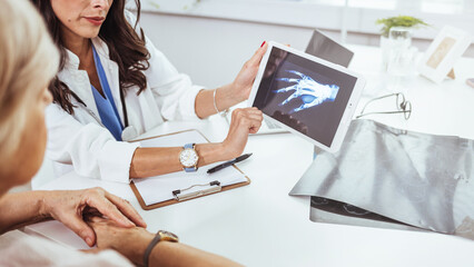 Young doctor examining x-ray of hands of a senior patient with arthritis. Radiography of a hand....