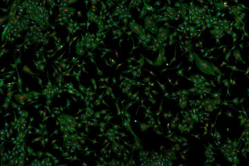 Microfilaments, nuclei, and mitochondria of fibroblasts
