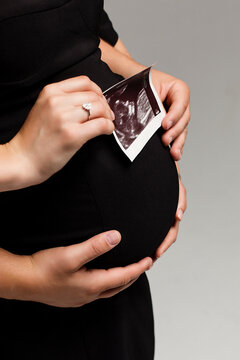 Women holding ultrasound picture of her future child in the arms of her husband
