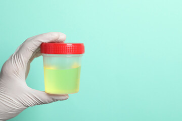 Doctor holding container with urine sample for analysis on turquoise background, closeup. Space for...