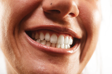Fototapeta premium Good looking teeth