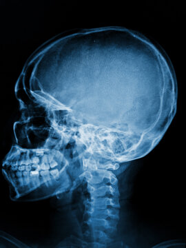 x ray image of human brain