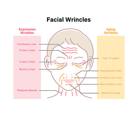 Obraz premium Expression wrinkles and Aging wrinkles ( female face ) vector illustration