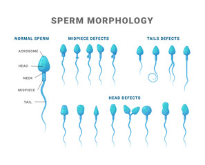 Sperm morphology count type educational medical scheme vector flat illustration