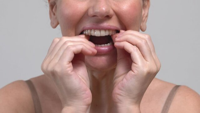 Close-up middle-aged woman putting on transparent aligners on the upper jaw Dental care and dentistry orthodontic concept