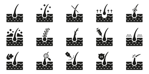 Hair Loss, Growth, Transplant, Removal, Care Silhouette Black Icon Set. Healthy Dermatology Therapy for Epidermis Glyph Pictogram. Hair Follicle Treatment Icon. Isolated Vector Illustration