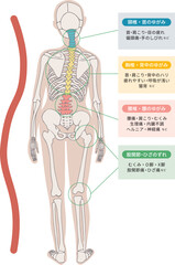 頸椎・胸椎・腰椎の歪みやずれによって生じる体の症状の図説