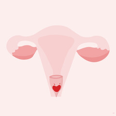Womb anatomy with inserted menstrual cup inside flat illustration. Menstruation ecological concept.