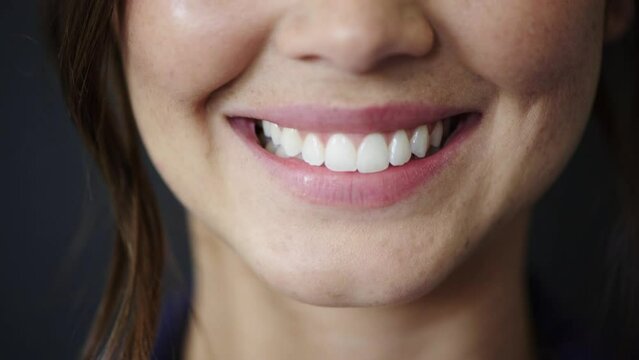 Face, smile and teeth with woman and dental zoom, oral care and healthcare for mouth for healthy gums. Teeth whitening, Invisalign and lips with beauty, orthodontist and veneers with fresh breath.
