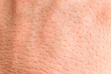 Abstract close-up human skin background texture.