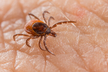 Close-up of deer tick on human skin detail in background. Ixodes ricinus or scapularis. Female...