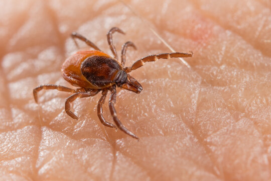 Close-up Of Deer Tick On Human Skin Detail In Background. Ixodes Ricinus Or Scapularis. Female Parasitic Mite On Textured Epidermis. Carrier Of Infectious Diseases As Encephalitis Or Lyme Borreliosis.