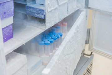 Keep isolated pathogens at ultra-low temperatures in the Laboratory freezer.