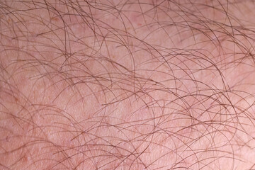 Fototapeta premium Skóra człowieka porośnięta czarnymi włosami. 