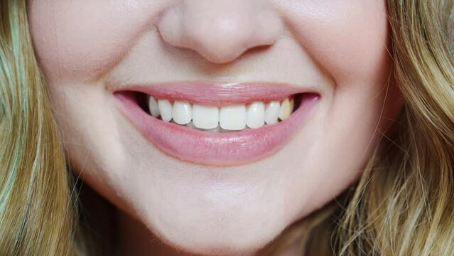 close-up. a woman's smile in the process of whitening teath