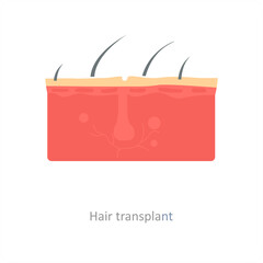 Hair transplant