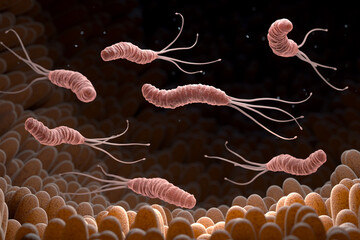 Helicobacter Pylori bacteria in the stomach