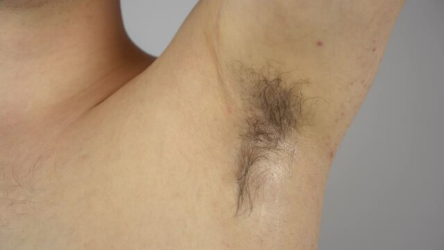 Man has wet armpits with long hair. Young bodypositive man sweating.