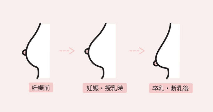 産後のバストのたるみのイラスト