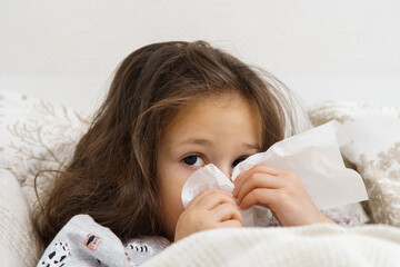 Adorable, feared little brunette girl blowing nose with tissues, look camera, lying in blanket on bed. Allergy season, contagious disease. Bedtime at home. Headache and seasonal allergy. Copy space