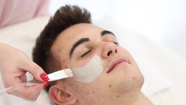 Young brunette hair man during peeling treatment in beauty clinic. Handsome man in cosmetology studio. Pimples and blackheads on the skin. Acne