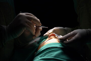 Doctor performing nose surgery in the operating room.  green dresses and black room in the operating room
