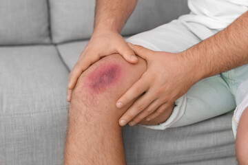 Man with bruise on his leg at home, closeup