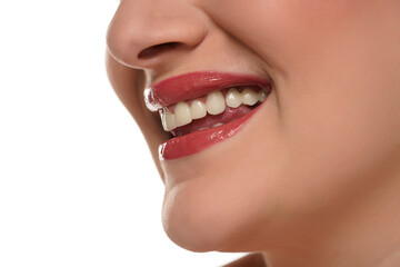 Naklejka premium Smile of a woman with porcelain teeth