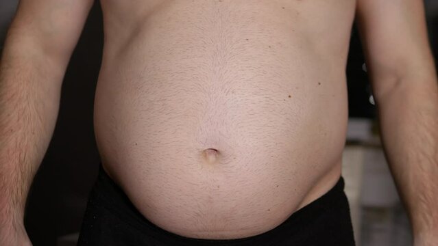 An overweight man demonstrates a big belly. Abdomen overgrown with fat. Problems with body weight. Obesity of a young man