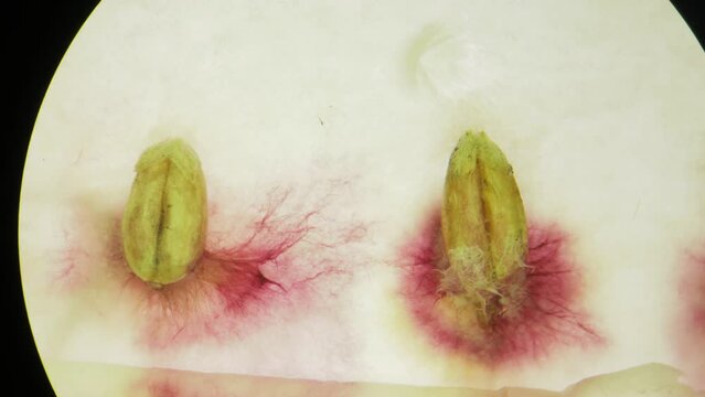 Laboratory Research of Plant Diseases. Phytoexamination of Seeds. Agriculture