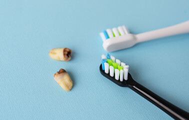 A modern electric toothbrush on a blue background next to extracted wisdom teeth affected by...