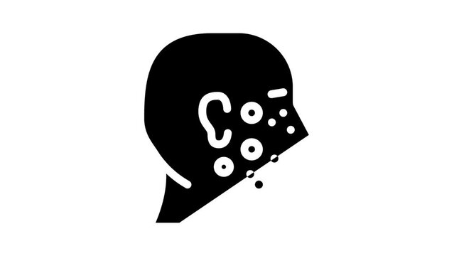 acne facial skin disease glyph icon animation