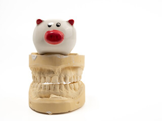 Dental casts and a piggy bank on a white background. Plaster model of teeth.