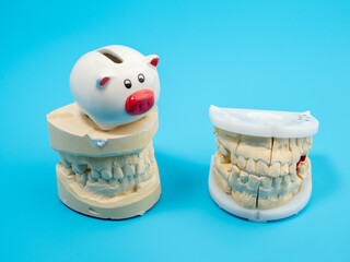 Dental casts and a piggy bank on a blue background. Plaster model of teeth.