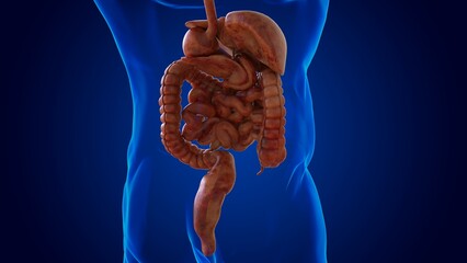 Human damaged digestive system for medical concept 3D