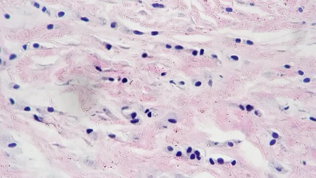 Teased human tendon in cross section magnified under microscope in 400 times on bright field. Learning people ligament with professional biological device in laboratory. Structure of connective fiber