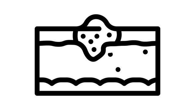 abstract problem skin disease line icon animation