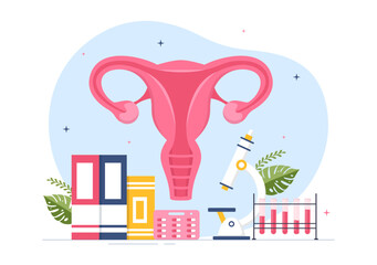 Endometriosis with Condition the Endometrium Grows Outside the Uterine Wall in Women for Treatment in Flat Cartoon Hand Drawn Templates Illustration