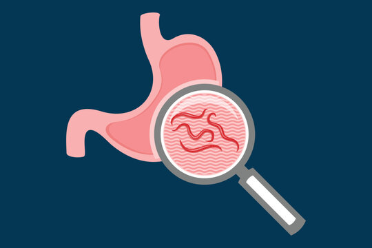 Oxyuriasis Bilder Durchsuchen 1,056 Archivfotos, und