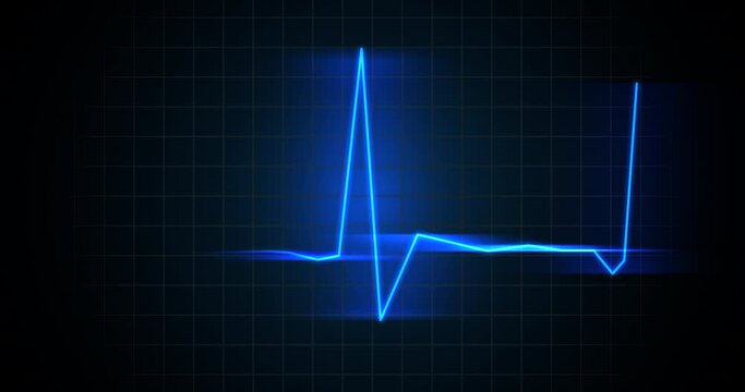 Heartbeat monitor animation. A smooth animation in high quality on a heart rate monitor in a hospital environment