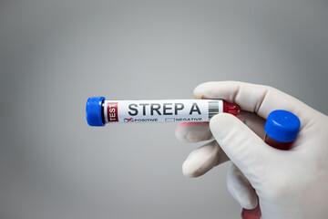 Obraz premium Blood collection tubes Group A Streptococcus(strep A or GAS) test positive results,medical concept