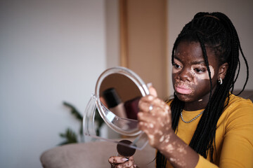 African American lady applying powder on face with vitiligo